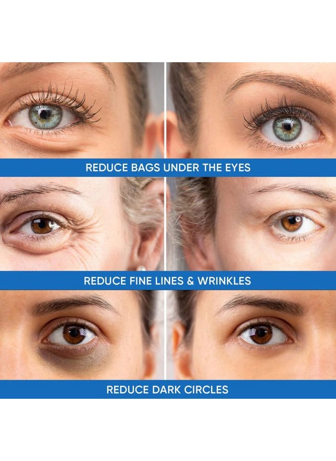 Dermlogic Under Eye Puffiness & Dark Circles Rapid Treatment- Instantly Reduces the Appearance of Puffy Eye Bags, Crow's Feet, & Sagging Skin.  - Image 3