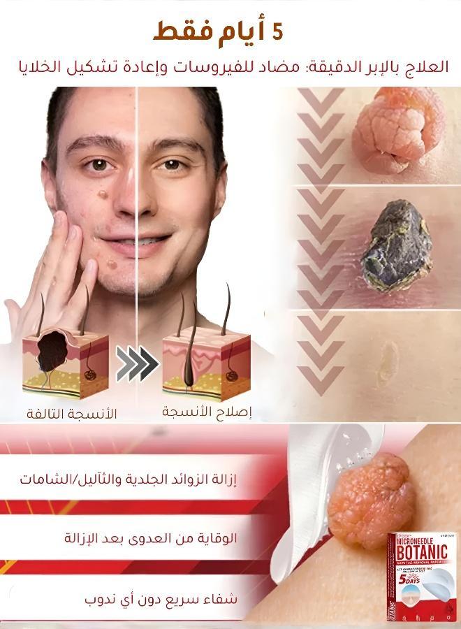 Fast-Acting Wart Removal Patches for Face & Body - Painless Skin Tag Remover Pads - Discreet & Invisible Adhesive Therapy - Safe for All Skin Types - Clear Skin - Image 2