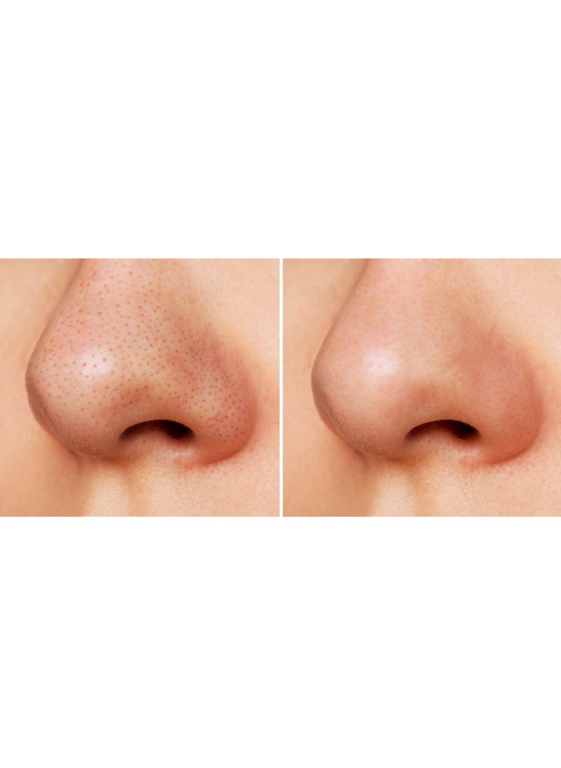 Ce-tua - Nose Pore Strips Orange Flavor - 3 Strips - Image 1