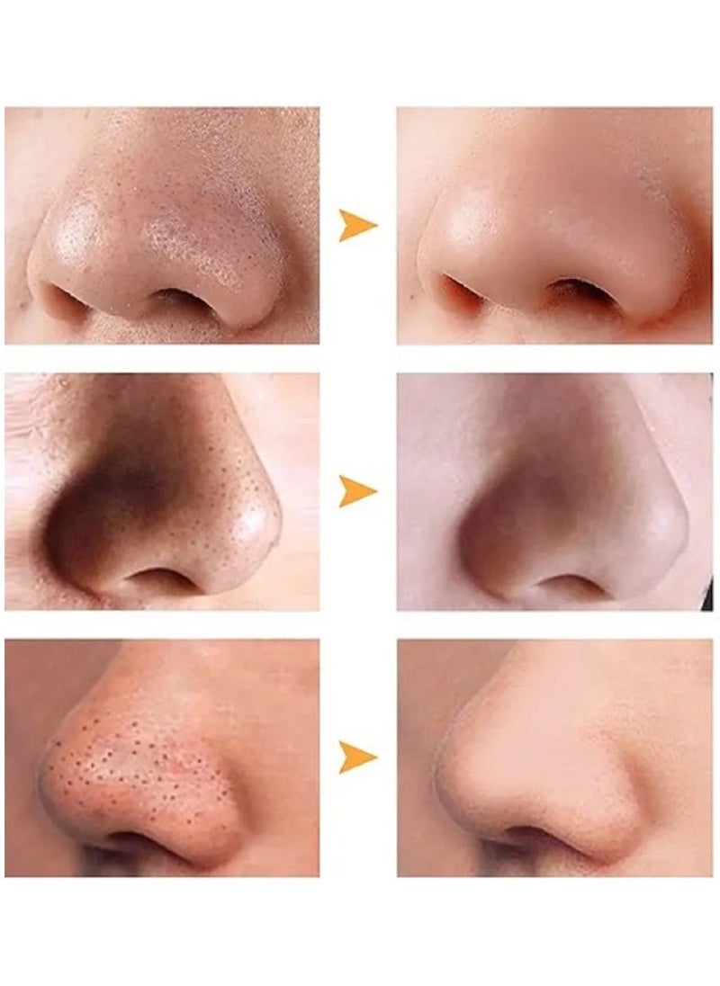 Ce-tua - Nose Pore Strips Orange Flavor - 3 Strips - Image 1