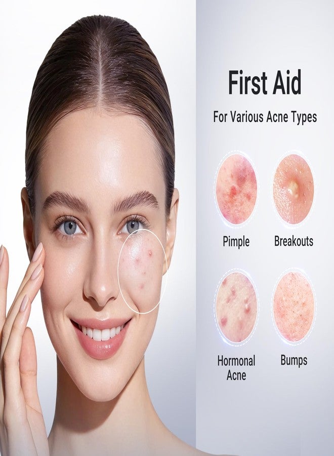 دكتور ليو لوشن دكتور ليو المجفف بحمض الساليسيليك بنسبة 1.8% - علاج حب الشباب للوجه، يقلل من الشوائب والبثور، يهدئ البقع وحب الشباب، مناسب للبشرة الحساسة، 0.34 أونصة سائلة (20 مل) - Image 3