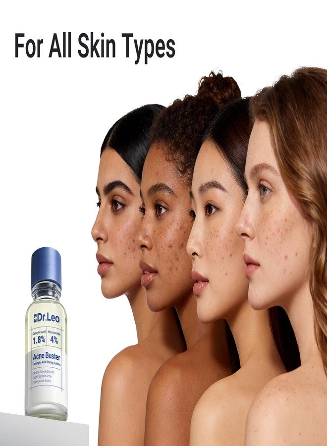 دكتور ليو لوشن دكتور ليو المجفف بحمض الساليسيليك بنسبة 1.8% - علاج حب الشباب للوجه، يقلل من الشوائب والبثور، يهدئ البقع وحب الشباب، مناسب للبشرة الحساسة، 0.34 أونصة سائلة (20 مل) - Image 5