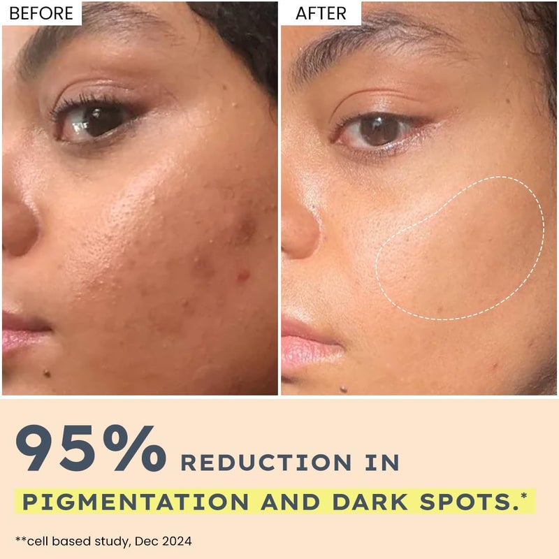 Hyphen 44 Rice Water Brightening Face Serum Pads 5 Niacinamide Alpha Arbutin to Reduces Dark Spots Pigmentation Toner Pads with Serum for Glowing Glass Skin All Skin Types 50N - Image 4