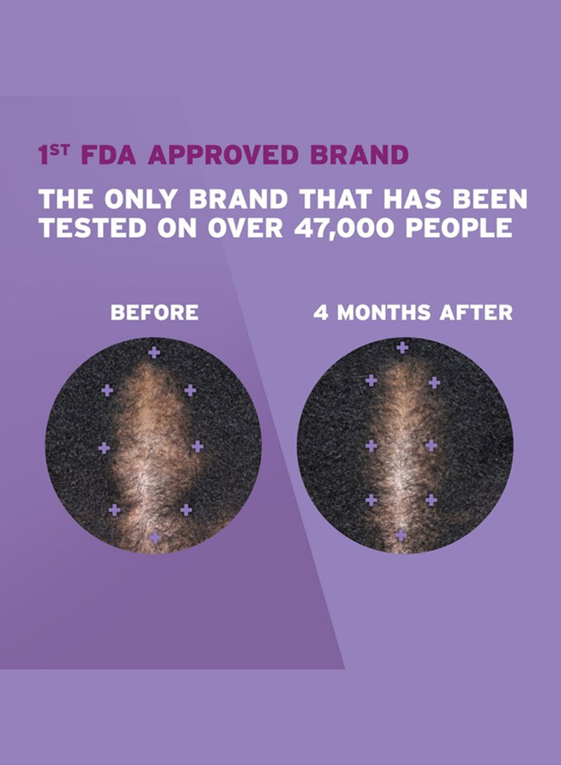 Rogaine Hair Regrowth Treatment Foam - Image 5