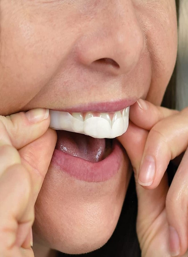 SleepRight ProRX Dental Guard, Ultra-Thin, Custom-Fit, Durable for Teeth Grinding, Comfortable for Sleeping (New Version) - Image 5