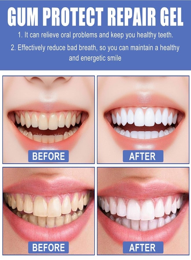 3Pcs Gum Protect Dental Repair Gel, Deep Cleaning Oral Gel, Fresh Breath Support, Soothing Gum Care and Moisturizing Teeth Gel (1ML x 3) - Image 3