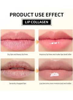 lakerain Lip Collagen Balm Lip Cream Lip Mask for Deep Moisturizing Hydrating Nourishing Smooth Soft Lips Moisturize Dry Chapped Lips Lip Collagen Mask Lip Makeup Primer Night Lip Mask 20G  - Image 5