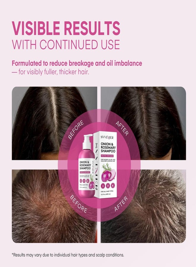 Svvimer Onion Rosemary and Biotin Shampoo - Hair Growth Shampoo for Hair Loss and Thinning - Thickening and Strengthening Formula for Men & Women Sulfate Free 13.5 Fl Oz (Pack of 1) - Image 2
