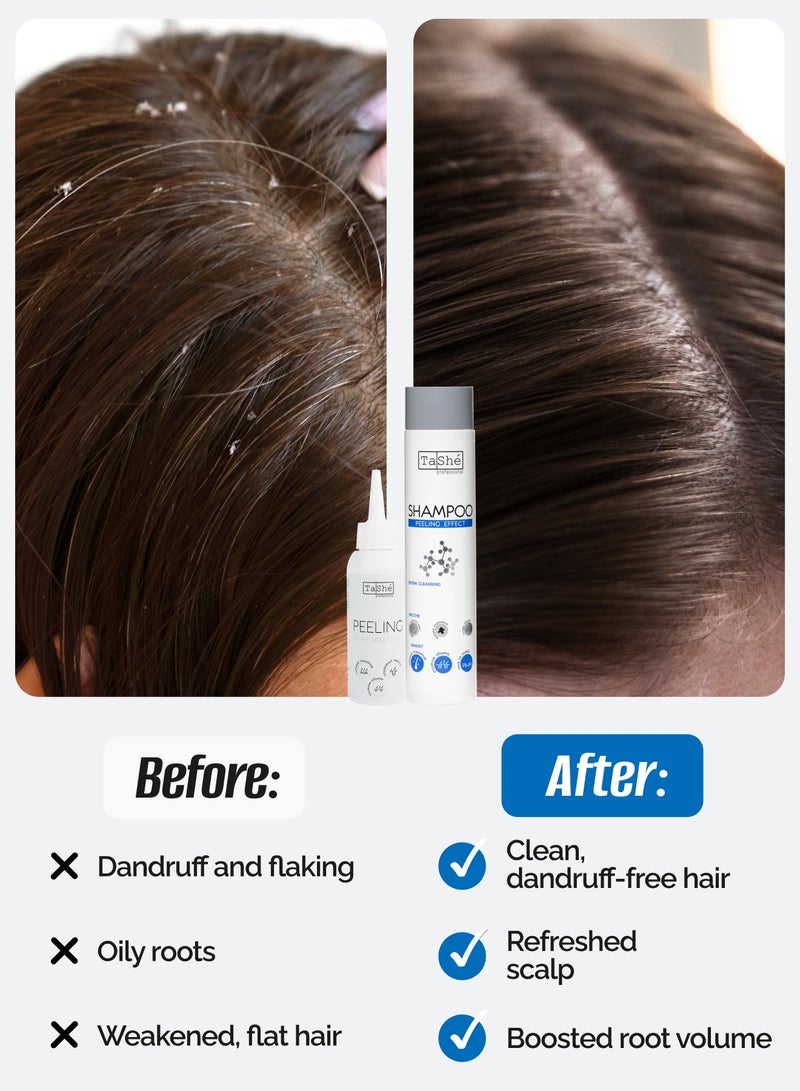 Tashe Hair Care Set – Peeling Scalp Treatment 100 ml & Anti-Dandruff Shampoo 300 ml with Zinc PCA, AHA Acids, Lime & Rosemary Extracts  - Image 2