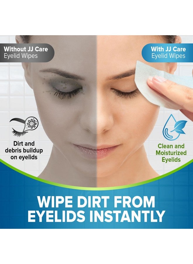 JJ CARE Eyelid Cleaning Wipes 80 Pcs, Individually Wrapped Eye Lid Scrubbing Wipes, Moisturizing Eye Wipes For Irritated, Itchy, And Dry Eyes, Hypoallergenic Eye Scrub Cleaning Pads - Image 3