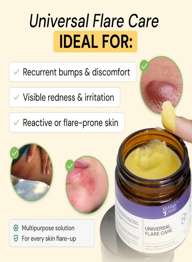 MyMagicHealer Universal Flare Care – Solution for Everyday Skin Flare-Ups | Drawing Salve for Boils & Cysts, Hidradenitis Suppurativa, Folliculitis | Irritated Skin and Chafing Relief 4 oz - Image 2
