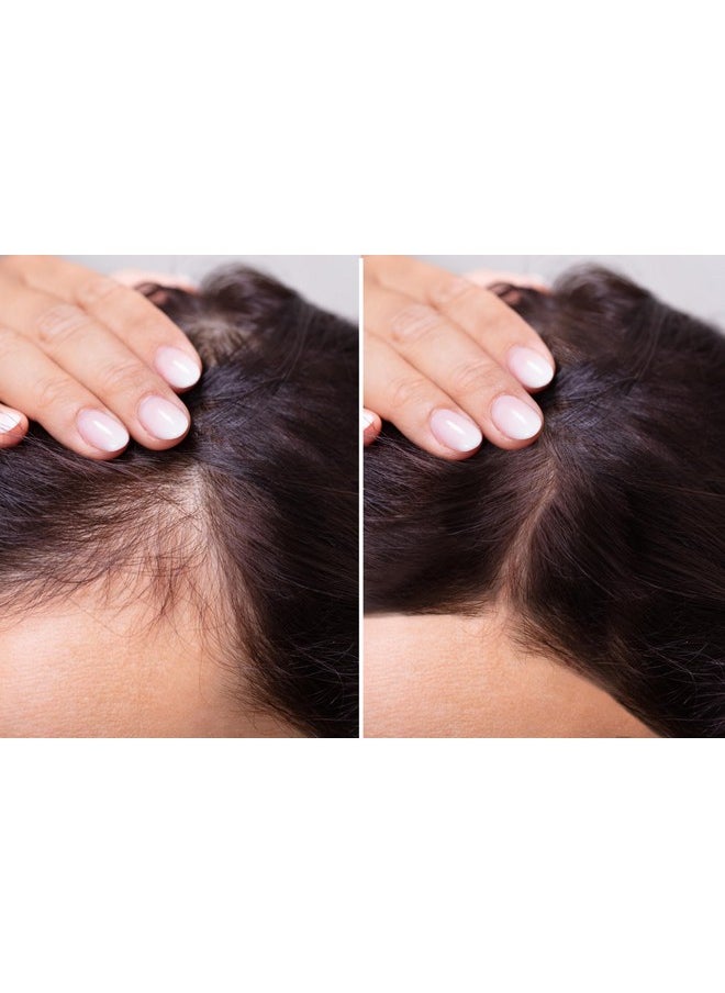 velona - Hair Growth Formula 4 Oz Castor Oil Amla Oil Jojoba Oil Argan Oil Rosemary Oil Peppermint Oil Tea Tree Oil Vitamin E Natural Mix With Organic Carrier And Essential Oils - Image 1
