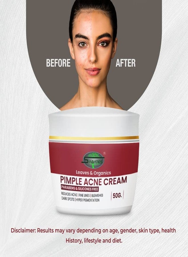 SABATES Pimple Acne Cream For Acne Scars & Marks Cream For Men Women || Acne Scars Corrector || Provides Glowing Skin || Suitable For All Skin Types | Pimple Cream For Girls - Image 4