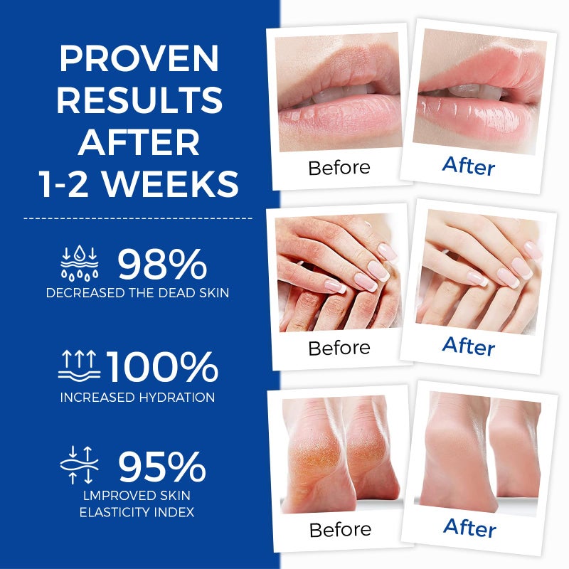 OUKEYA Healing Ointment, Advanced Therapy Skin Protectant, Multi-Purpose Healing Ointment and Body Moisturizer, For Dry, Cracked Skin, Minor Cuts and Burns, Soothes Cracked Hands and Chapped Lips - Image 3