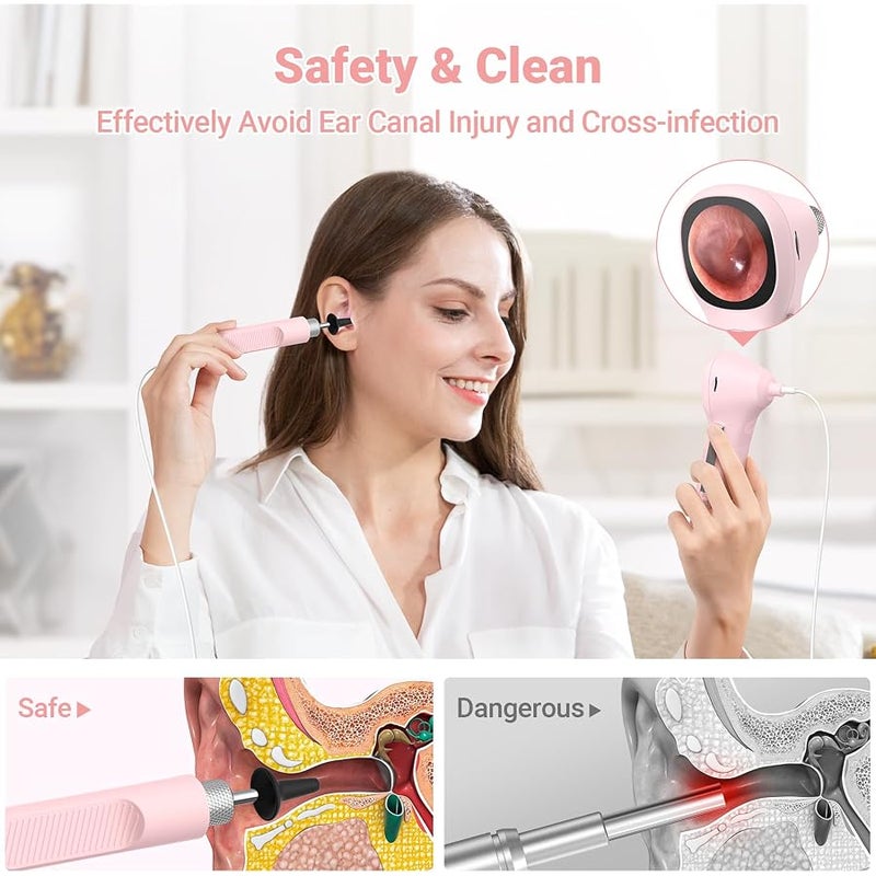 ScopeAround Digital Otoscope w/IPS Screen, 720p HD Smart Video Otoscope with Light, Ear Scope Otoscope with Camera Ear Wax Removal Camera, Ear Checker, Power On and Go, Pink - Image 5