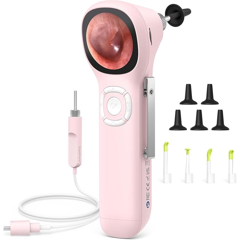 ScopeAround Digital Otoscope w/IPS Screen, 720p HD Smart Video Otoscope with Light, Ear Scope Otoscope with Camera Ear Wax Removal Camera, Ear Checker, Power On and Go, Pink - Image 1