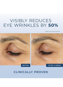 RoC RoC Retinol Correxion Eye Cream Mini for Dark Circles & Puffiness, Daily Wrinkle Cream, Anti Aging Line Smoothing Skin Care Treatment, .25 Ounces  - Image 3