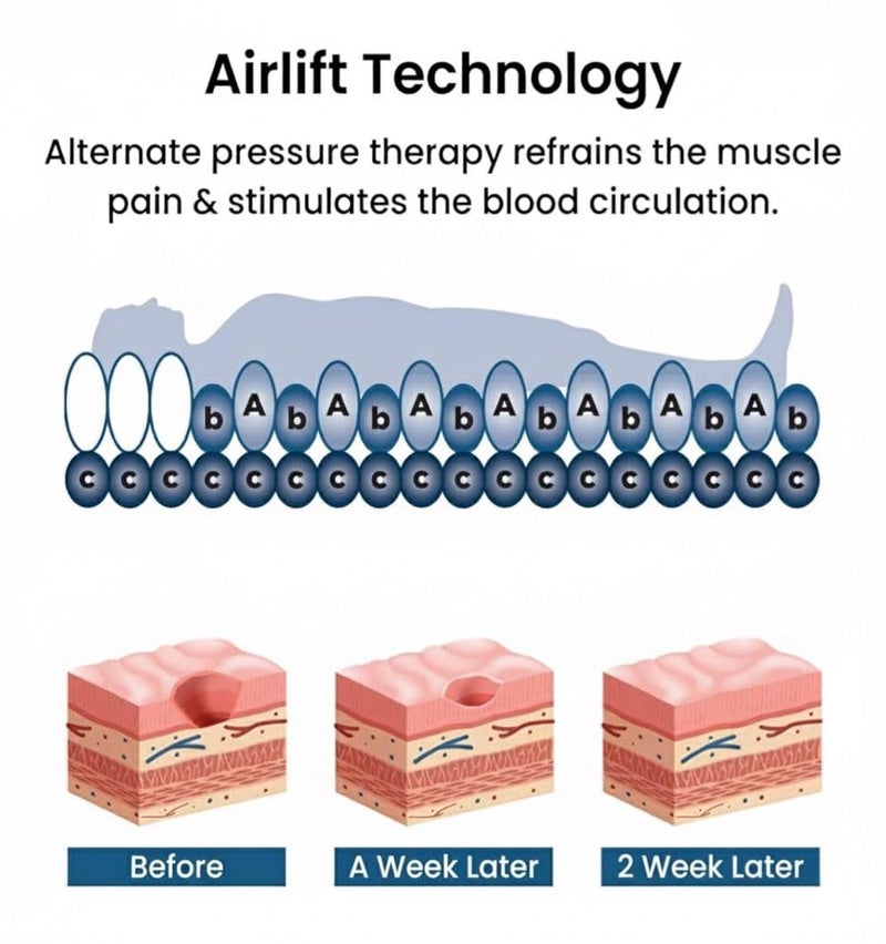 Caresome Air Mattress Therapy for Bed Sores Anti-Decubitus|Bubble Mattress| Anti-Bedsore Air Mattress with Compressor Inflatable Air Bed (Cream) - Image 5