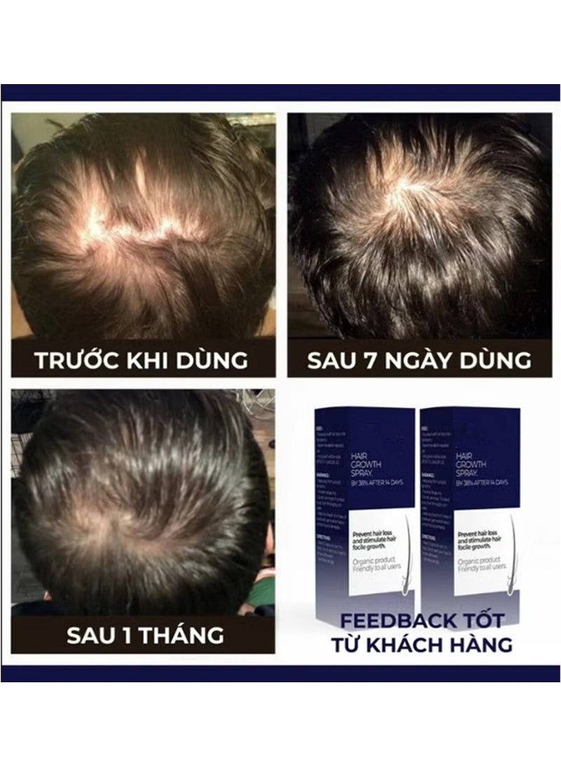 Hair Growth Spray 2PCS - Prevent Hair Loss and Stimulate Hair Follicle Growth - Image 3