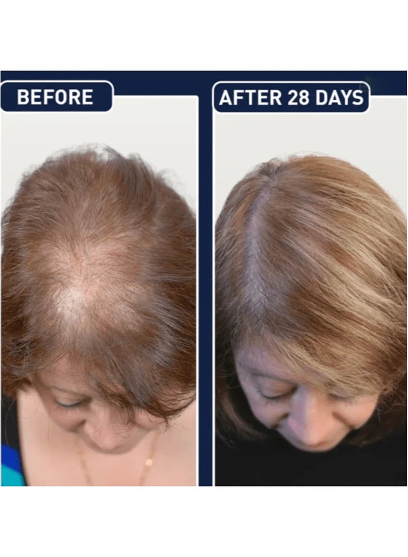 Hair Growth Spray 2PCS - Prevent Hair Loss and Stimulate Hair Follicle Growth - Image 5
