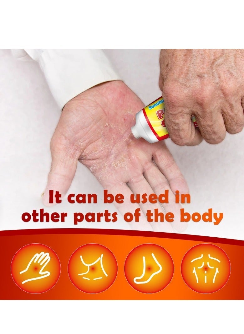 Sumifun كريم الصدفية، كريم سعفة الجلد، كريمات الصدفية العشبية الصينية الطبيعية، تعمل بشكل فعال على قمع الصدفية والحكة الجلدية من خلال - Image 3