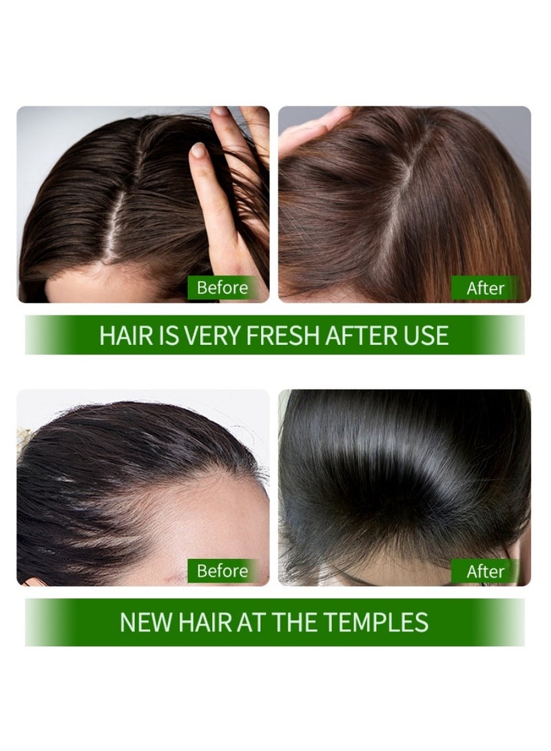 سكابراديس زيت إكليل الجبل (الروزماري) للشعر بمستخلصات نباتية ثلاثية – ترطيب، تنعيم، ومنع التساقط  تغذية عميقة لفروة الرأس | إصلاح التقصف وتحفيز النمو  علاج عضوي طبيعي  - Image 4