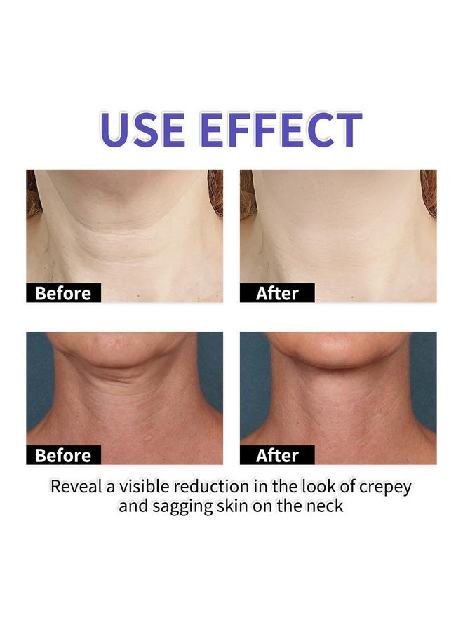 YG LianKai - YG LianKai Neck Firming Cream, Tighten & Lift Neck Firming Cream, Anti-Aging Neck Creams for Tightening Lifting Sagging Skin and Hydrating, Help Reduce Fine Lines & Wrinkles - Image 1