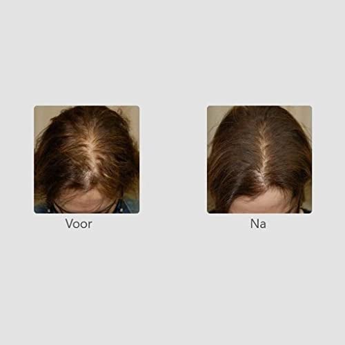 Foligain Triple Action Conditioner For Thinning Hair For Women with 2% Trioxidil | Hair Stimulating Volumizing Conditioner (16oz) (15244) - Image 4