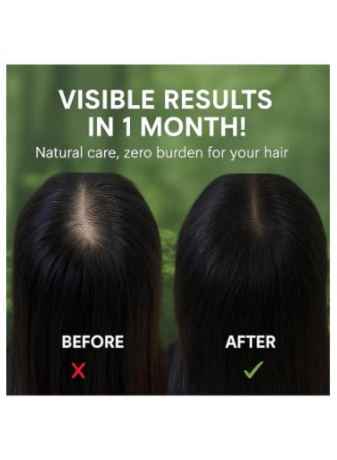 طبيعة شامبو مثلث الطبيعة - Image 4