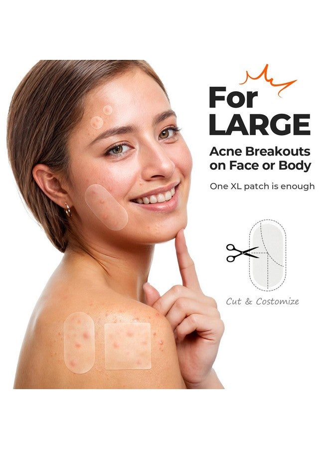 تي كيه تي كيه رقعة كبيرة لعلاج حب الشباب من TKTK للوجه، رقعة كبيرة لعلاج حب الشباب، 60 × 30 مم، ضمادات كبيرة من مادة الهيدروكولويد للجسم والظهر والجبهة والذقن والرقبة (بيضاوي، مربع، نقطي، 5 مقاسات، 265 رقعة) - Image 3