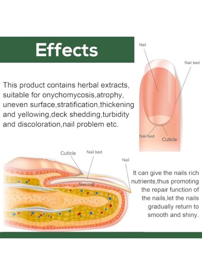 إيلهو علاج فطريات الأظافر للأصابع - زيت فاخر مضاد للفطريات لإصلاح الأظافر الضعيفة والسميكة والمتغيرة اللون والتالفة، الحل المثالي للأظافر المدفونة (50 مل) - Image 4