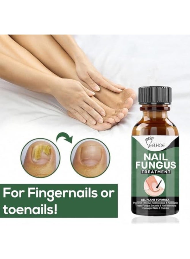 إيلهو علاج فطريات الأظافر للأصابع - زيت فاخر مضاد للفطريات لإصلاح الأظافر الضعيفة والسميكة والمتغيرة اللون والتالفة، الحل المثالي للأظافر المدفونة (50 مل) - Image 2