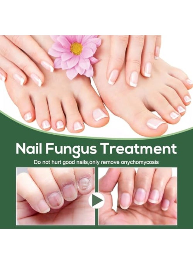 إيلهو علاج فطريات الأظافر للأصابع - زيت فاخر مضاد للفطريات لإصلاح الأظافر الضعيفة والسميكة والمتغيرة اللون والتالفة، الحل المثالي للأظافر المدفونة (50 مل) - Image 5
