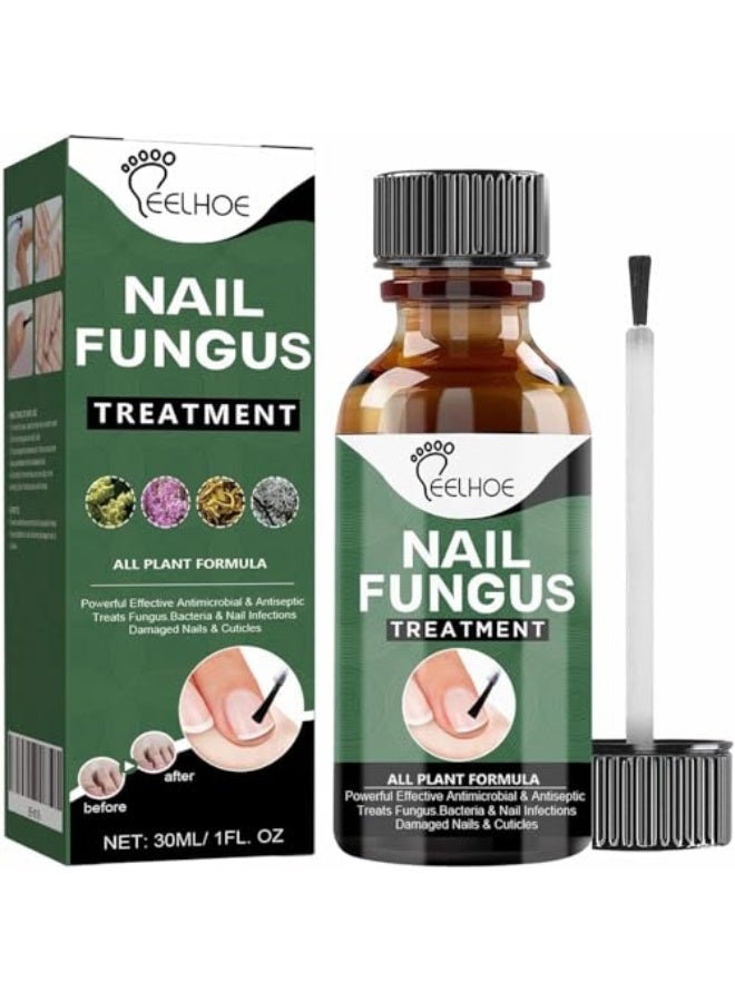 إيلهو علاج فطريات الأظافر للأصابع - زيت فاخر مضاد للفطريات لإصلاح الأظافر الضعيفة والسميكة والمتغيرة اللون والتالفة، الحل المثالي للأظافر المدفونة (50 مل) - Image 1