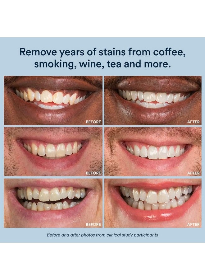 Auraglow Whitening Toothpaste Booster, Add to Toothpaste to Whiten, 9% Hydrogen Peroxide Teeth Whitening Toothpaste, 350+ Whitening Treatments, 6-Month Supply, 2.6oz - Image 5