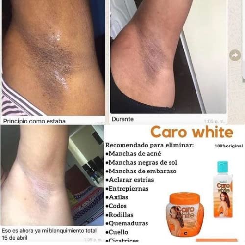 Caro White Set3 Lotion 1014oz Cream 1014oz Soap 63oz - Image 3