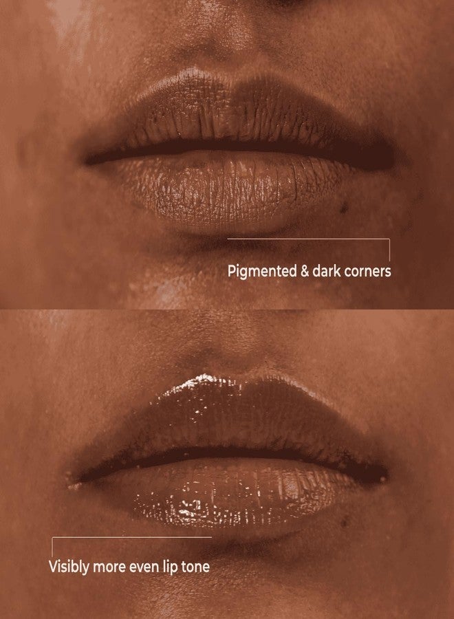 سكين فيست مرطب شفاه ليلي Skinvest Melts Repair + Brighten، علاج ترميمي مع PDRN وWonderlight™ والسيراميد وحمض الهيالورونيك | قناع ليلي غني للشفاه الجافة والمتصبغة والمتقشرة | 10 مل - Image 5
