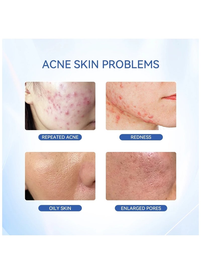 Dr.Leo Dr.Leo Salicylic Acid Acne Treatment Drying Lotion - Image 4