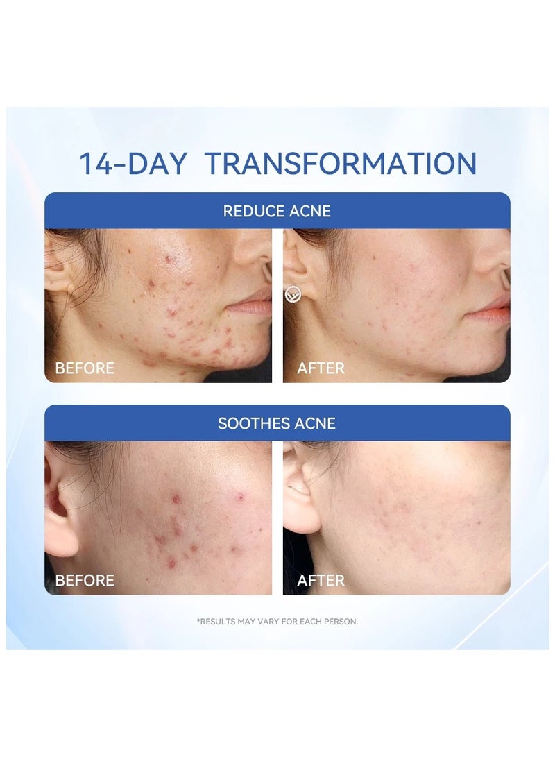 Dr.Leo Dr.Leo Salicylic Acid Acne Treatment Drying Lotion - Image 5