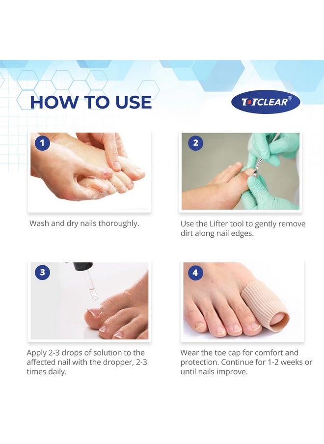 TOTCLEAR Ingrown Toenail Relief: Ingrown Toenail Tool for Men Women - Ingrown Toenail Removal Kit - Ingrown Toenail Corrector Drops - Ingrown Toenail Remover - Effective Solution for Ingrown Toenails - 30ml  - Image 4