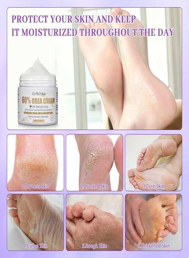 Clyecfra 5-in-1 60% Urea Cream with 2% Salicylic Acid, Urea Cream 60 Percent for Feet & Hands- Maximum Strength Moisturizer for Rough, Dry, Thick & Cracked Skin, Callus Remover, Deep Hydration, 150g - Image 5
