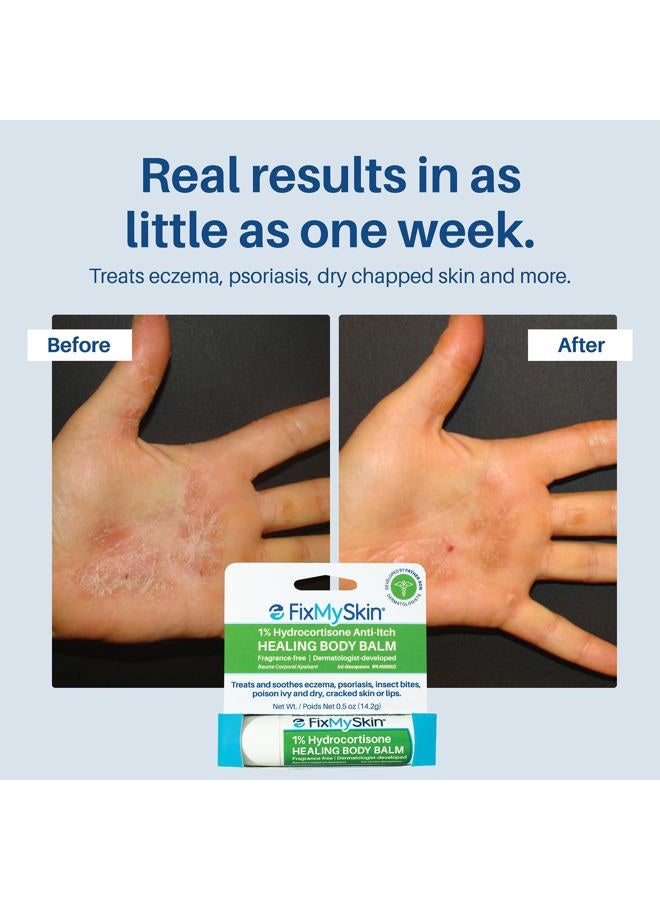 FixMySkin 1% Hydrocortisone Healing Body Balm – Fast Itch Relief, Dry Skin & Eczema Treatment, Heals Cracked Skin, Travel-Friendly Moisturizing Balm for Psoriasis, Dermatitis & Rashes, 0.5 oz - Image 5