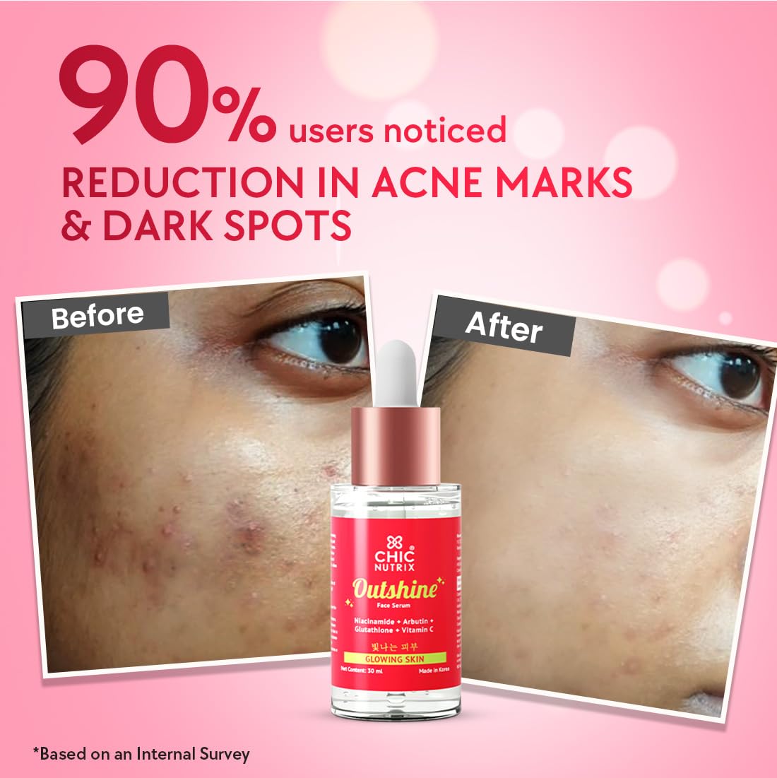 Chicnutrix Outshine Korean Brightening Face Serum Made in Korea 5 Powerful Actives Niacinamide Glutathione Vitamin C For Pigmentation Dark Spots Acne