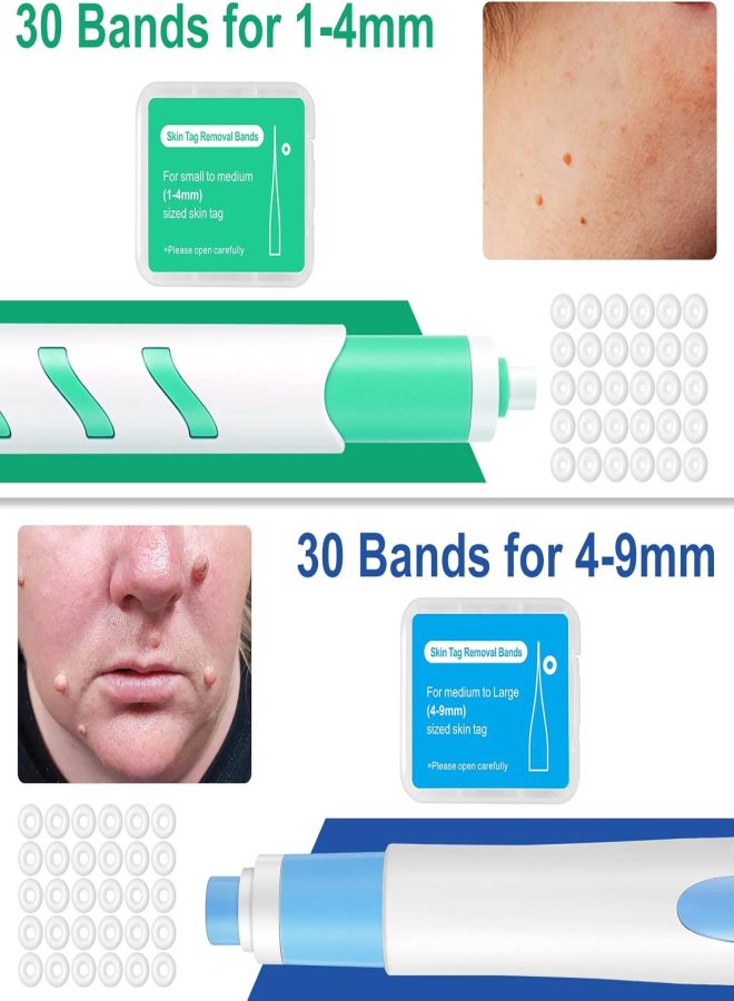 Wart removal tool set, corn care tool for removing skin, flesh particles (including 60 removal rings, 36 repair stickers and 20 cleaning wipes, suitable for 1-9mm size leather pads, painless and convenient) - Image 2