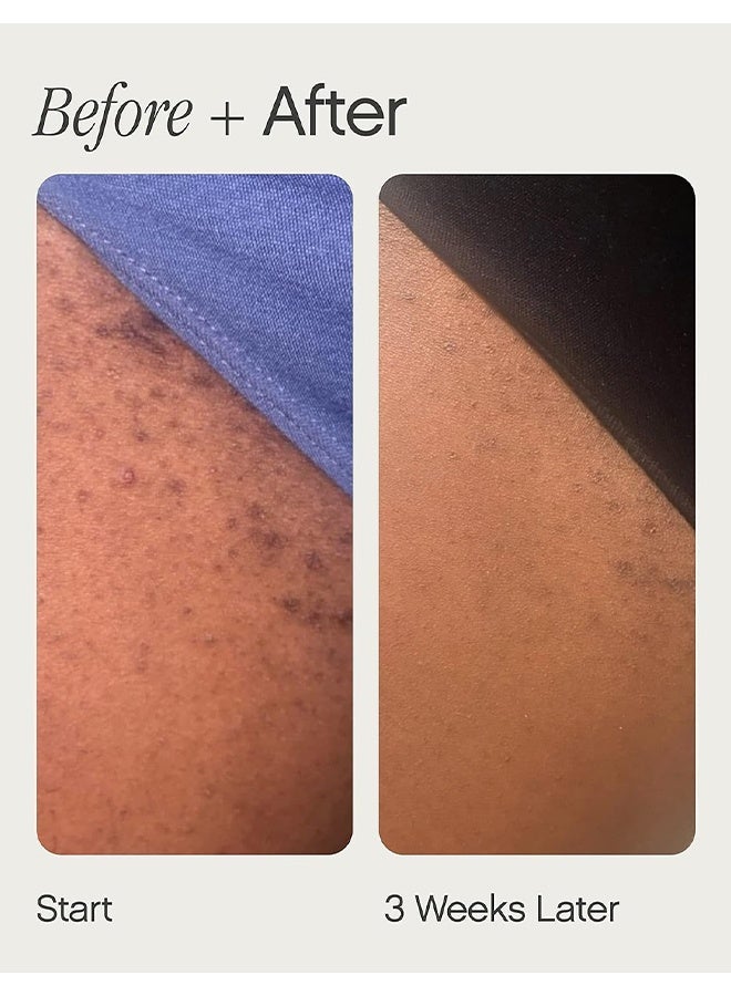 TOPICALS Ingrown Tonic Lolion Tonique Pour Poils Incarnes 50ml, High Roller Ingrown Hair Tonic, Daily Treatment For Razor Bumps, Irritation And Ingrown Hairs, Contains Salicylic And AHAs And BHAs, Suitable For Face And Body - Image 5