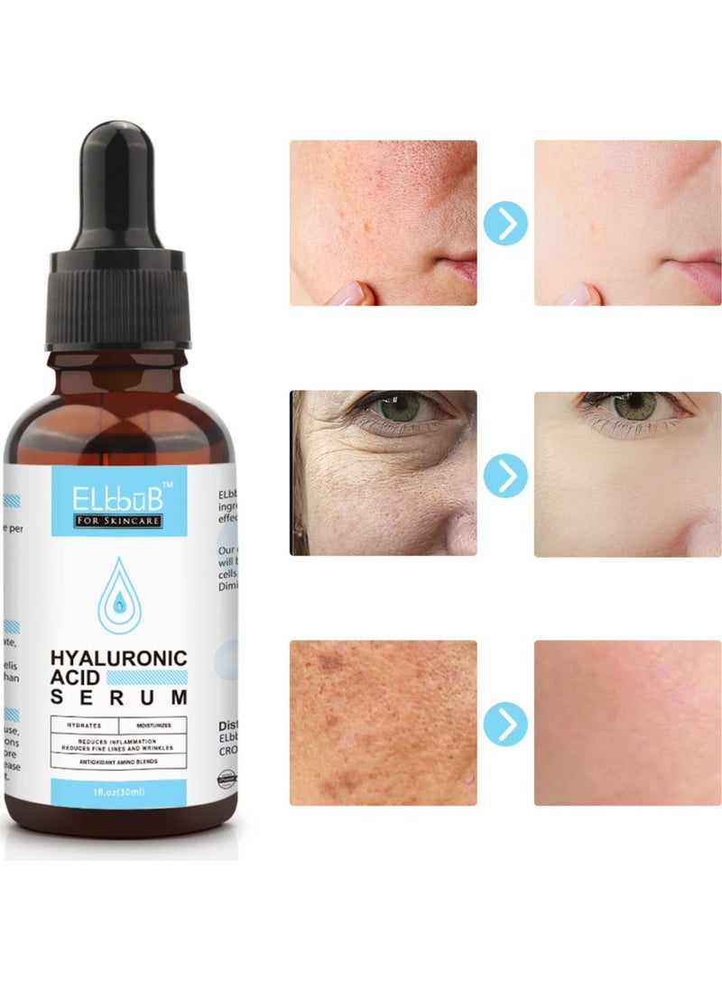 ELBBUB - Hyaluronic Acid Serum Moisturizing Wrinkle Serum for Erasing Fine Lines and Wrinkles Soft Hydrating Easy Absorption Anti Aging Serum Perfect Hydrating Serum for Face and Dry Skin Face Serum 30ml - Image 1
