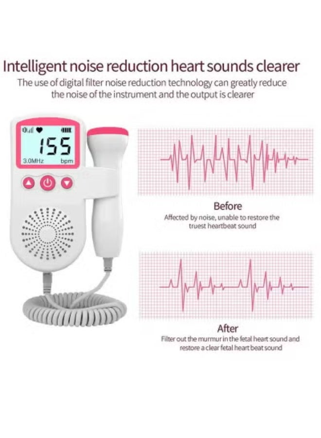 Halamine Fetal Heart Rate Monitor, Portable Ultrasound Doppler - Image 4