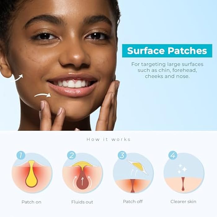 Cleof Hydrocolloid Pimple Patches (Made in Korea) FSA/HSA Eligible - Vegan, Hypoallergenic, Cruelty-Free Acne Circle Stickers for Overnight Use, for Zits, Spots, Pimples, Whiteheads (10 Count, XL) - Image 3