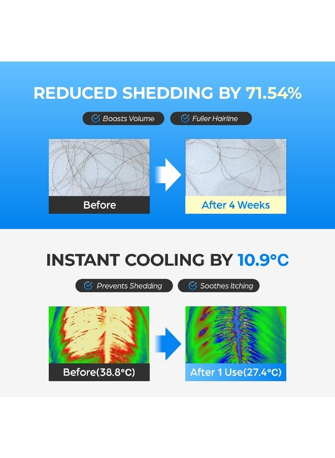 Seapuri علاج موضعي لنمو الشعر بتأثير فيروسي من سكالفى لتساقط الشعر، ترقق الشعر واستعادة خط الشعر | جهاز تدليك فروة الرأس مع كرة سكالفى - Image 3