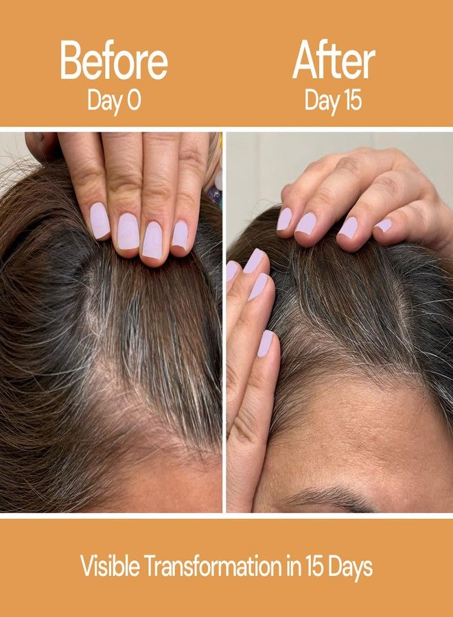 سيتا سيروم سيتا لنمو الشعر - ريدينسيل 3%، أناجين 2%، كابيليا لونغا 1% مع البيوتين، إكليل الجبل والحلبة - يقلل من تساقط الشعر وترققه، ويعزز نموه، ويعالج فروة الرأس - تم اختباره من قبل أطباء الجلدية - 50 مل - Image 4